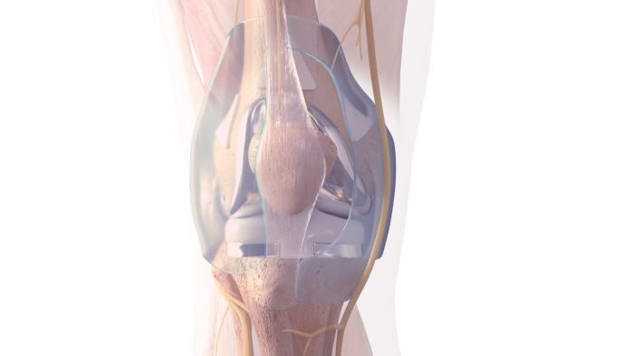 由Allay Therapeutics开发的植入物可在膝关节手术后缓解疼痛