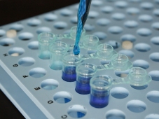 制药用水微生物限度样品取样操作中消毒步骤的探讨
