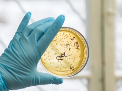 微生物生化鉴定的影响因素探究
