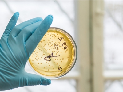 药品无菌检查中污染微生物的鉴定