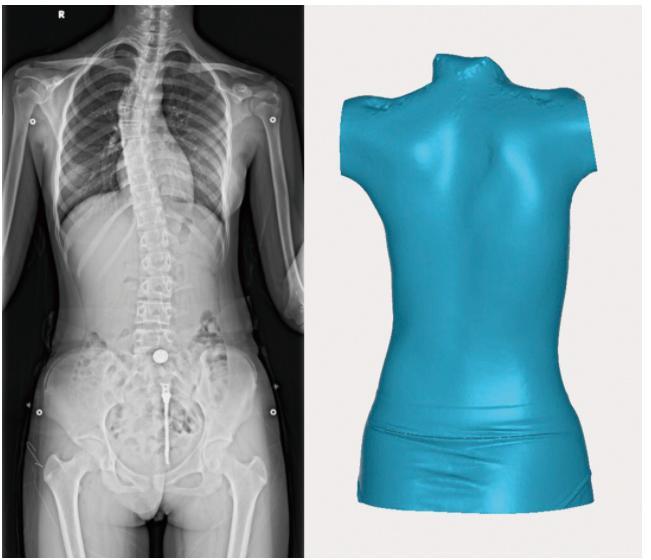 图1 医学影像与3D扫描数据