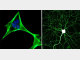 首次直接将鼠皮肤细胞转化为神经细胞