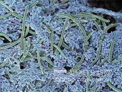 纯水机水箱中的生物膜污染控制