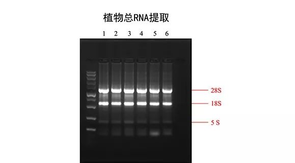 rna电泳图中的三条条带图片