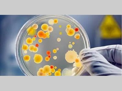 15种常用的杀菌方式汇总