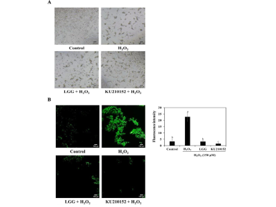 植物乳杆菌KU210152及其发酵豆浆对神经具有保护作用
