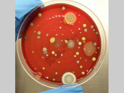 常见微生物菌落图，你都认识吗？