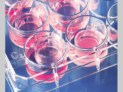乳糖发酵培养基在微生物学研究中的应用