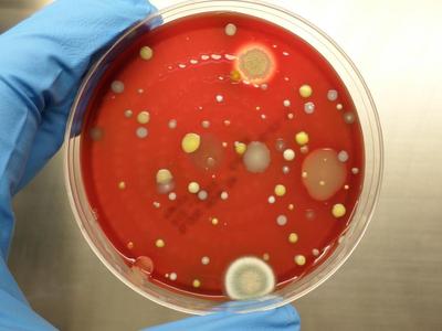 【收藏】微生物实验室常用仪器设备操作规程