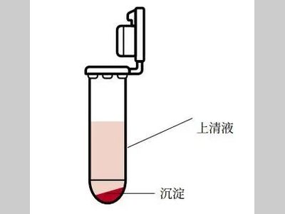 离心机的种类与选择