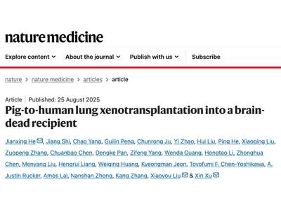 Nature Medicine：世界首例！我国学者成功将基因编辑猪肺移植到人体内