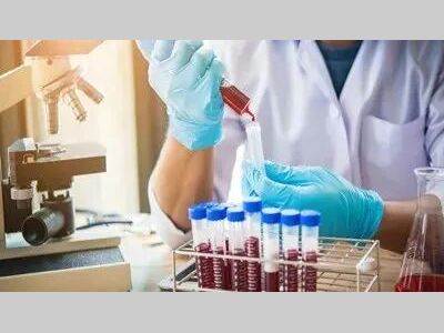 【必看】液相色谱柱填料是如何影响柱能的？