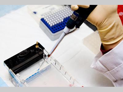 微生物定量接种技术——滴板法