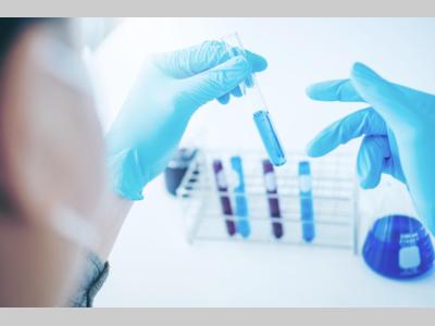 管理评审常见10个问题，避坑！