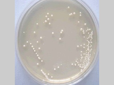 实验室常用微生物菌种的分离和纯化方法